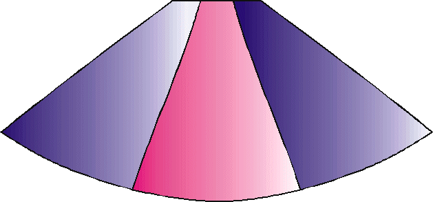 Seitenteile in Zweitfarbe