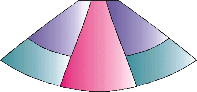 Seitenteile in Zweitfarbe mit extra Rand